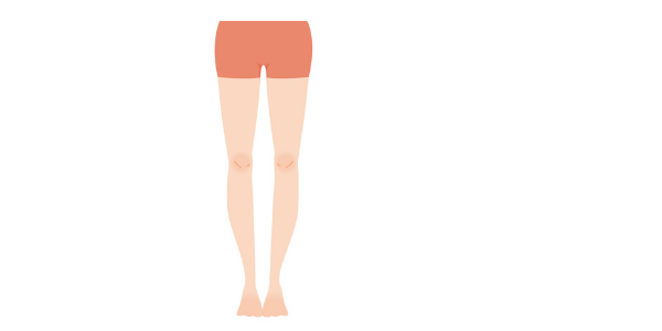 股関節のO脚の図