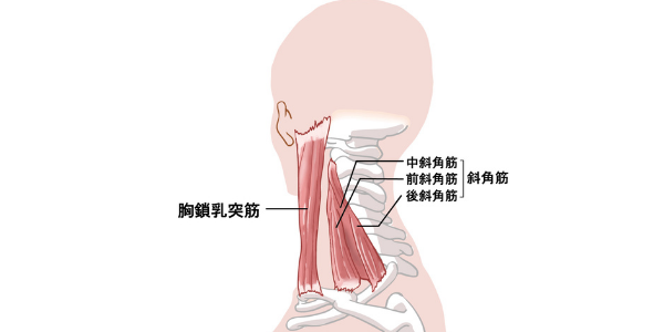 胸鎖乳突筋と斜角筋を表した図
